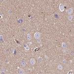 Nhe-1 Antibody in Immunohistochemistry (IHC)