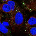 Syntabulin Antibody in Immunocytochemistry (ICC/IF)