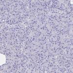 BAG6 Antibody in Immunohistochemistry (Paraffin) (IHC (P))