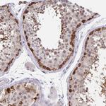 BAG6 Antibody in Immunohistochemistry (Paraffin) (IHC (P))