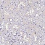 RhoV Antibody in Immunohistochemistry (IHC)