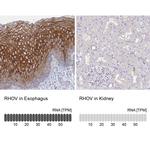 RhoV Antibody