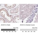 ZC3H14 Antibody in Immunohistochemistry (IHC)