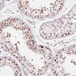 ZC3H14 Antibody in Immunohistochemistry (IHC)