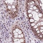 ZC3H14 Antibody in Immunohistochemistry (IHC)