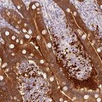 DHRS11 Antibody in Immunohistochemistry (Paraffin) (IHC (P))