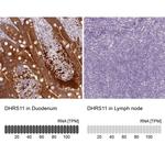 DHRS11 Antibody in Immunohistochemistry (IHC)