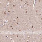 METTL13 Antibody in Immunohistochemistry (Paraffin) (IHC (P))