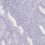 UGT1A6 Antibody in Immunohistochemistry (IHC)