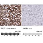 BCAT2 Antibody in Immunohistochemistry (IHC)