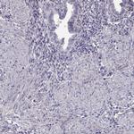 SLCO6A1 Antibody in Immunohistochemistry (IHC)