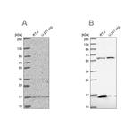 MRPS16 Antibody in Western Blot (WB)