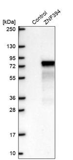 ZNF394 Antibody in Western Blot (WB)