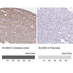 SLC8A2 Antibody in Immunohistochemistry (IHC)