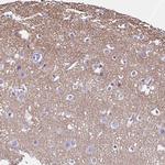 SLC8A2 Antibody in Immunohistochemistry (IHC)