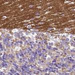 SLC8A2 Antibody in Immunohistochemistry (IHC)