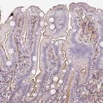 B3GALT5 Antibody in Immunohistochemistry (Paraffin) (IHC (P))