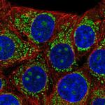 B3GNT4 Antibody in Immunocytochemistry (ICC/IF)