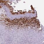 B3GNT4 Antibody in Immunohistochemistry (IHC)