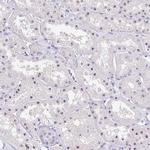 FTSJ3 Antibody in Immunohistochemistry (Paraffin) (IHC (P))