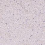 ALP Antibody in Immunohistochemistry (IHC)