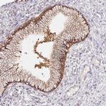 ALP Antibody in Immunohistochemistry (IHC)