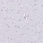 Azurocidin Antibody in Immunohistochemistry (IHC)