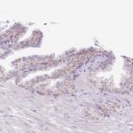 HEXB Antibody in Immunohistochemistry (IHC)