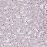 HEXB Antibody in Immunohistochemistry (IHC)