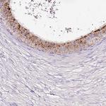 HEXB Antibody in Immunohistochemistry (IHC)