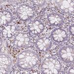 HEXB Antibody in Immunohistochemistry (IHC)