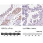 HSD17B3 Antibody in Immunohistochemistry (IHC)