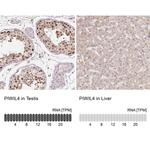 PIWIL4 Antibody in Immunohistochemistry (IHC)