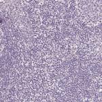 CYP11B2 Antibody in Immunohistochemistry (Paraffin) (IHC (P))