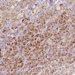 CYP11B2 Antibody in Immunohistochemistry (IHC)