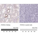 FXYD4 Antibody in Immunohistochemistry (IHC)