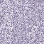 FXYD4 Antibody in Immunohistochemistry (IHC)