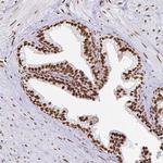 hnRNP U Antibody in Immunohistochemistry (Paraffin) (IHC (P))