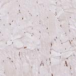 hnRNP U Antibody in Immunohistochemistry (Paraffin) (IHC (P))