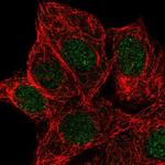 KCNK5 Antibody in Immunocytochemistry (ICC/IF)