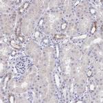 KCNK5 Antibody in Immunohistochemistry (Paraffin) (IHC (P))