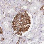 MYO1B Antibody in Immunohistochemistry (Paraffin) (IHC (P))