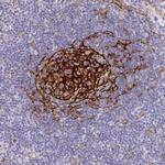 MYO1B Antibody in Immunohistochemistry (Paraffin) (IHC (P))