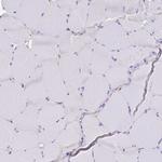 MYO1B Antibody in Immunohistochemistry (Paraffin) (IHC (P))