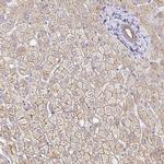 MYO1B Antibody in Immunohistochemistry (IHC)