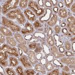 DCST1 Antibody in Immunohistochemistry (Paraffin) (IHC (P))