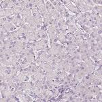 SLC7A8 Antibody in Immunohistochemistry (IHC)