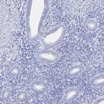 HSPA4L Antibody in Immunohistochemistry (IHC)