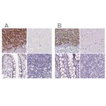 FDX1 Antibody in Immunohistochemistry (IHC)