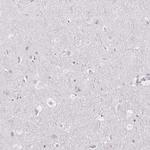 FDX1 Antibody in Immunohistochemistry (IHC)